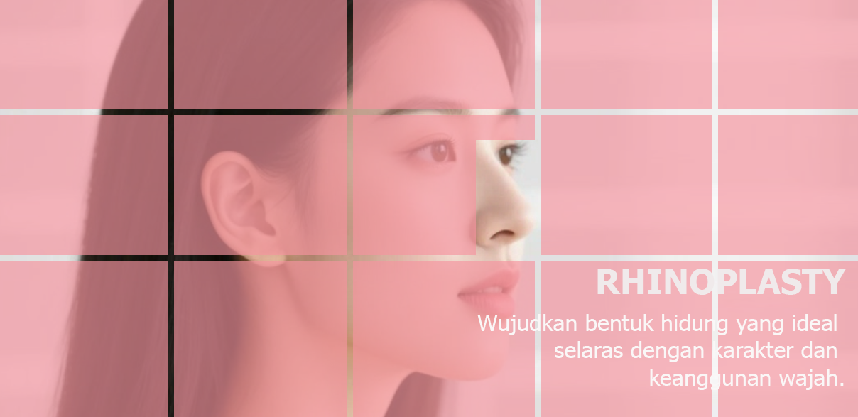 Hasil Operasi Hidung