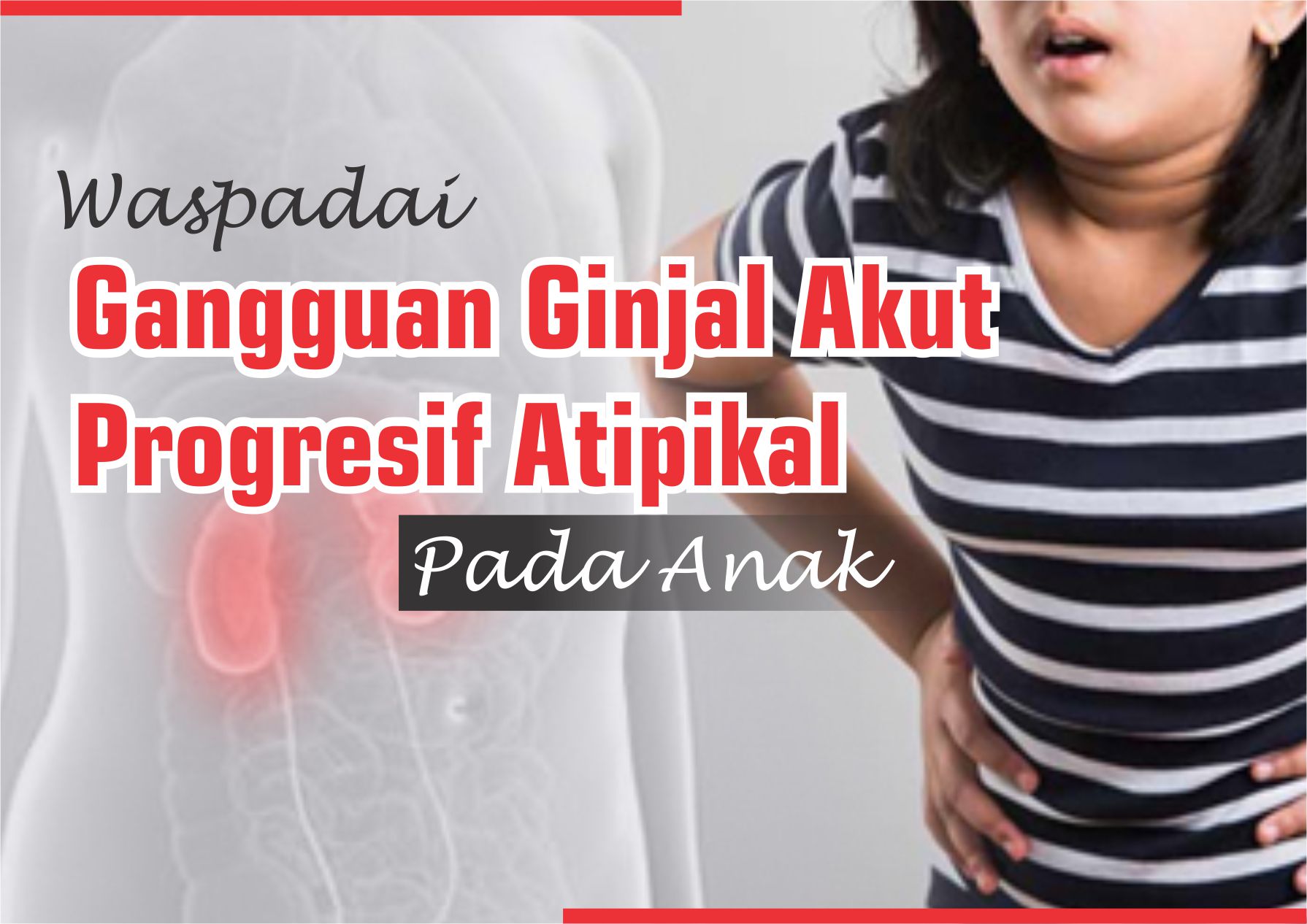 Gangguan Ginjal Akut Progresif Atipikal pada Anak